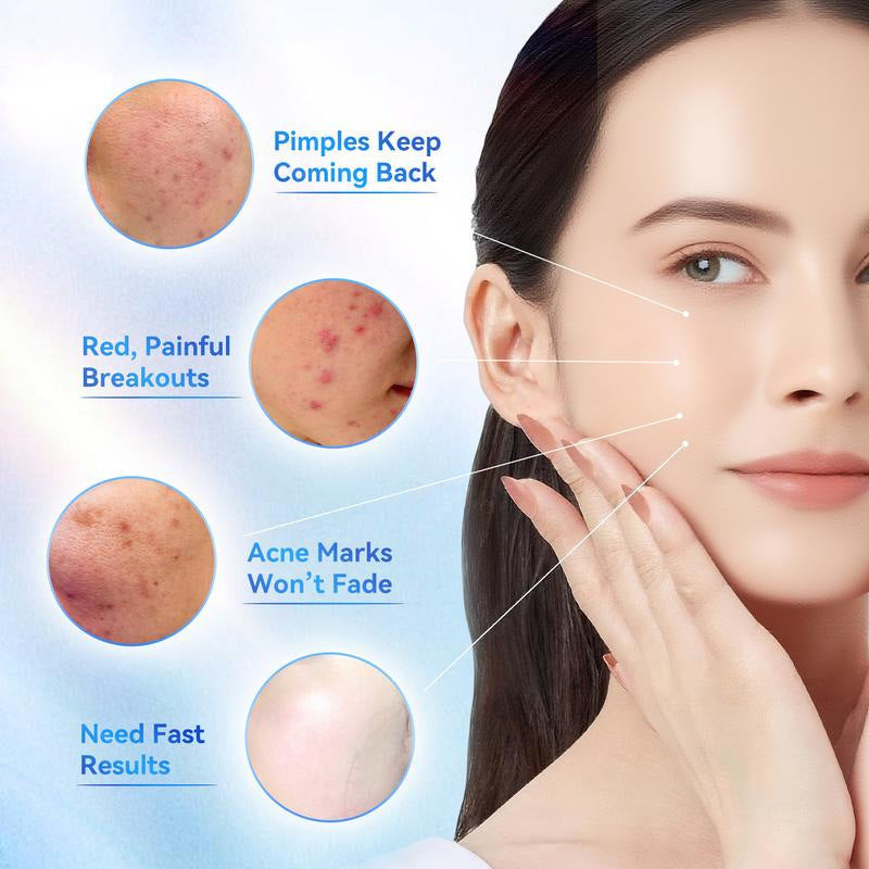 KOE™ Drying Pimple Lotion